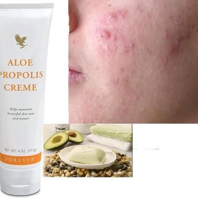 ALOE PROPOLIS CREME